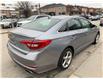 2017 Hyundai Sonata  (Stk: H489311) in Scarborough - Image 5 of 24