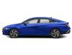 2025 Hyundai Elantra Luxury (Stk: 34574) in Scarborough - Image 2 of 12