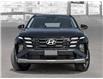 2025 Hyundai Tucson Preferred w/Trend Package (Stk: 25695) in Toronto - Image 2 of 20