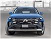 2025 Hyundai Tucson Preferred (Stk: 25690) in Toronto - Image 2 of 22