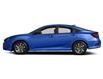 2017 Honda Civic EX (Stk: P11125B) in Ottawa - Image 2 of 11