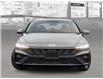 2025 Hyundai Elantra Luxury (Stk: 25701) in Toronto - Image 2 of 19