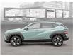 2025 Hyundai Kona 2.0L Preferred (Stk: 25709) in Toronto - Image 3 of 21