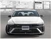 2025 Hyundai Elantra N Line Ultimate (Stk: 25713) in Toronto - Image 2 of 20