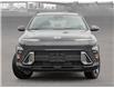 2025 Hyundai Kona 2.0L Preferred (Stk: 25722) in Toronto - Image 2 of 23