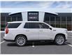 2024 GMC Yukon Denali (Stk: R100861) in Scarborough - Image 5 of 24