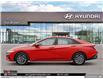 2025 Hyundai Elantra Preferred (Stk: U971234) in Brooklin - Image 3 of 23