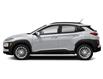 2018 Hyundai Kona 2.0L Preferred (Stk: 32196AZ) in Thunder Bay - Image 2 of 11