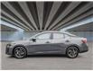 2025 Nissan Sentra SV (Stk: 875651) in Toronto - Image 3 of 21