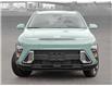 2025 Hyundai Kona 2.0L Preferred (Stk: 25709) in Toronto - Image 2 of 21
