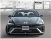 2025 Hyundai Elantra N Line Ultimate (Stk: 25731) in Toronto - Image 2 of 21