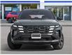 2025 Hyundai Tucson XRT (Stk: 2600028) in Aurora - Image 2 of 22