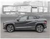 2025 Hyundai Kona 1.6T N Line Ultimate (Stk: 25737) in Toronto - Image 3 of 23