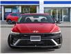 2025 Hyundai Elantra N Line Ultimate (Stk: 2600117) in Aurora - Image 2 of 20