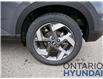 2025 Hyundai Venue Ultimate IVT w/Black Interior (Stk: 373959) in Whitby - Image 32 of 35