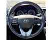 2020 Hyundai Elantra Ultimate (Stk: 25101132A) in Markham - Image 12 of 22