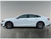 2021 Chevrolet Malibu RS (Stk: P40048) in Saskatoon - Image 2 of 15