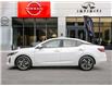 2025 Nissan Sentra SV (Stk: 250254) in Toronto - Image 3 of 22