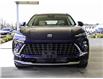 2024 Buick Envision Avenir (Stk: SG34077) in St. Marys - Image 2 of 25