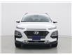 2020 Hyundai Kona 1.6T Ultimate (Stk: F0685) in Saskatoon - Image 5 of 25