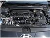 2025 Hyundai Elantra Luxury (Stk: 25762) in Toronto - Image 6 of 22