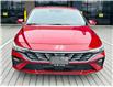 2025 Hyundai Elantra Luxury (Stk: 16U101336) in Markham - Image 2 of 10