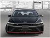 2025 Hyundai Elantra N Base (Stk: 25770) in Toronto - Image 2 of 20