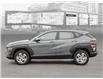 2025 Hyundai Kona 2.0L Essential (Stk: 25775) in Toronto - Image 3 of 23