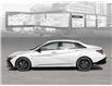 2025 Hyundai Elantra N Line Ultimate (Stk: 25713) in Toronto - Image 3 of 20