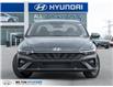 2025 Hyundai Elantra Preferred (Stk: 993086) in Milton - Image 2 of 23