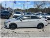 2022 Hyundai Elantra HEV Ultimate (Stk: 2600116A) in Aurora - Image 6 of 20