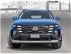 2025 Hyundai Tucson Preferred w/Trend Package (Stk: 25796) in Toronto - Image 2 of 18