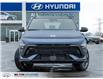 2025 Hyundai Kona 1.6T N Line (Stk: 240697) in Milton - Image 2 of 23