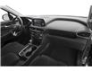 2020 Hyundai Santa Fe Luxury 2.0 (Stk: SS-301A) in Calgary - Image 11 of 11