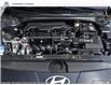 2025 Hyundai Elantra Luxury w/Two-Tone Interior (Stk: N988061) in Charlottetown - Image 6 of 24