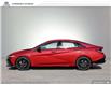 2025 Hyundai Elantra N Line Ultimate (Stk: N982534) in Charlottetown - Image 3 of 22