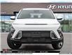 2025 Hyundai Kona 2.0L Preferred (Stk: U301006) in Brooklin - Image 2 of 26