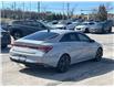 2022 Hyundai Elantra HEV Ultimate (Stk: 2600116A) in Aurora - Image 3 of 20