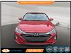 2020 Hyundai Elantra ESSENTIAL (Stk: 934660) in Lower Sackville - Image 2 of 18