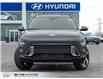 2025 Hyundai Kona  (Stk: 294691) in Milton - Image 2 of 23