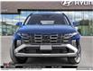 2025 Hyundai Tucson Plug-In Hybrid Ultimate (Stk: U334068) in Brooklin - Image 2 of 24