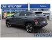 2025 Hyundai Kona 2.0L Preferred AWD (Stk: 300455) in Whitby - Image 8 of 33