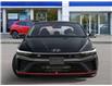 2025 Hyundai Elantra N Base (Stk: 26T1285) in Aurora - Image 2 of 20