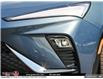 2025 Buick Envista Sport Touring (Stk: B208486) in WHITBY - Image 10 of 26