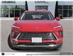 2025 Buick Envision Preferred (Stk: B39672) in Cobourg - Image 2 of 24
