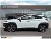 2020 Hyundai Kona 1.6T Ultimate (Stk: F0700) in Saskatoon - Image 6 of 29