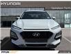 2020 Hyundai Kona 1.6T Ultimate (Stk: F0700) in Saskatoon - Image 4 of 29