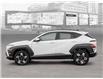 2025 Hyundai Kona 2.0L Preferred w/Trend Package (Stk: 25853) in Toronto - Image 3 of 22