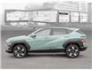2025 Hyundai Kona 2.0L Preferred w/Trend Package (Stk: 25852) in Toronto - Image 3 of 19