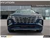 2022 Hyundai Tucson Hybrid Ultimate (Stk: 90393A) in Saskatoon - Image 4 of 21